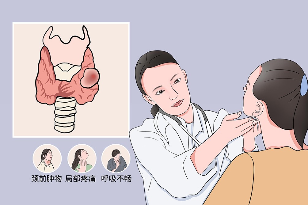 甲状腺囊肿的诊断与处理：何时需要进一步的检查与治疗？