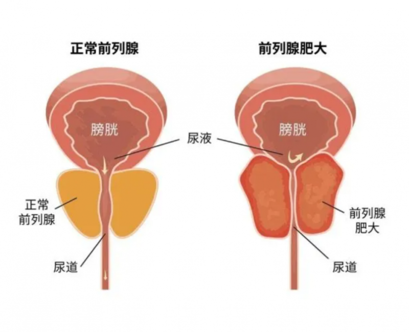 LAIFE「乐维源」靶向提升前列腺活力，让男人动力不再受“腺”制！