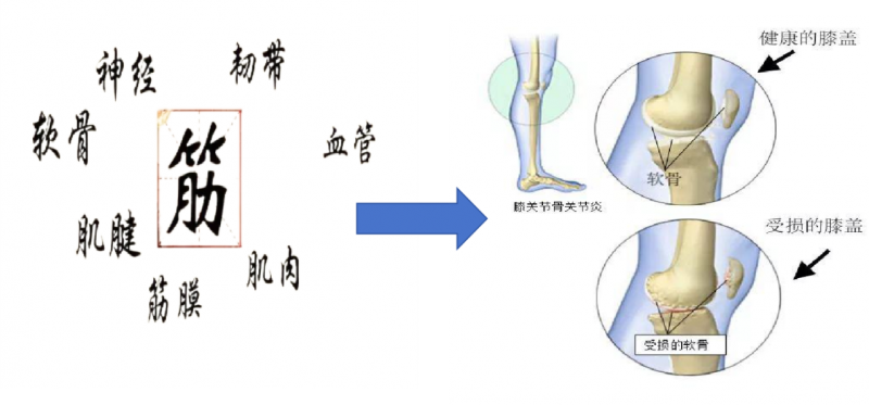 中西医结合治疗膝骨关节炎的策略及关节软骨修复再生技术的探索