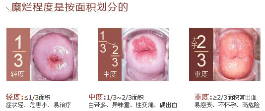 张东宇老师女性健康问题专访：原来女性子宫保养这么关键。(图2)