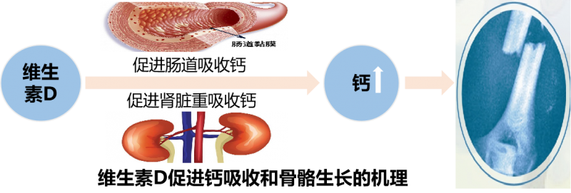 守护骨骼健康，谨记维生素D这一营养素不可或缺！