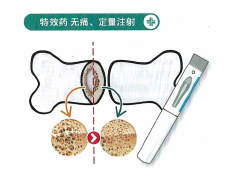 龙脊康惠州惠城店即将开业，精准诊疗新升级！(图7)